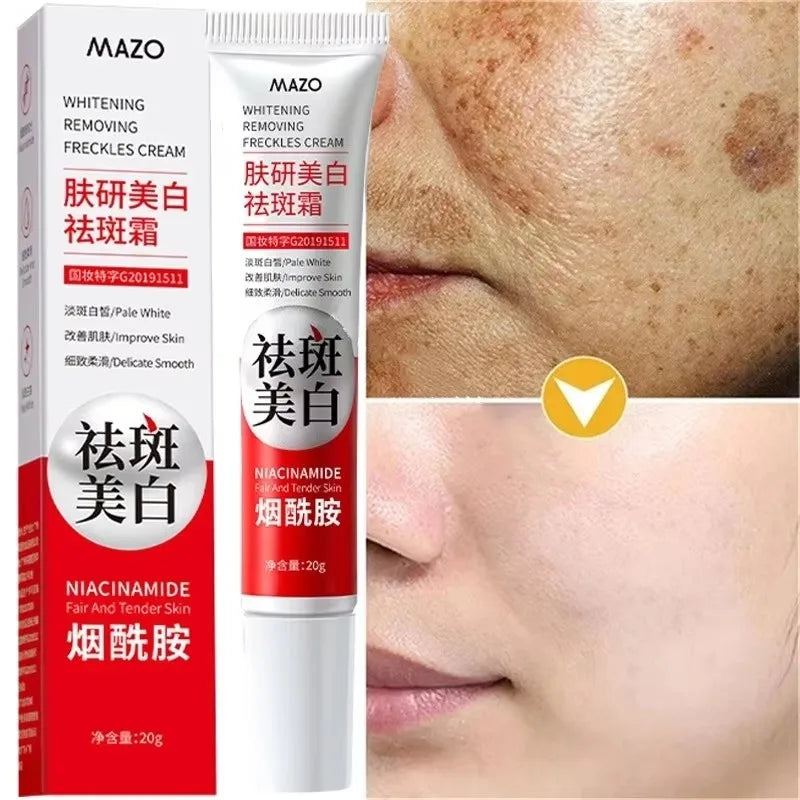 Dark Spot Brightening Cream – Eliminates Melanin, Melasma & Pigmentation, Korean Skin Care