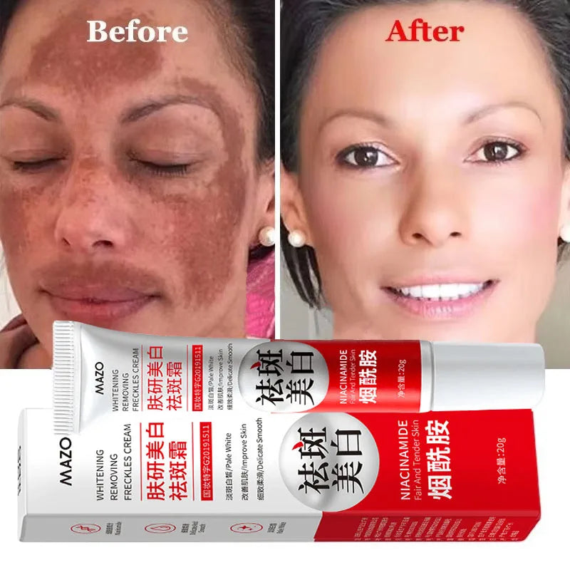 Dark Spot Brightening Cream – Eliminates Melanin, Melasma & Pigmentation, Korean Skin Care
