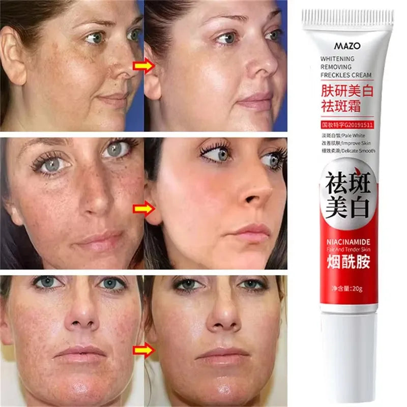 Dark Spot Brightening Cream – Eliminates Melanin, Melasma & Pigmentation, Korean Skin Care